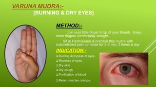 VARUNA MUDRA:-
[BURNING & DRY EYES]
METHOD:-
Join your little finger to tip of your thumb. Keep
other fingers comfortably straight.
Sit in Padmasana & practice this mudra with
outstretched palm on knee for 3-5 min; 3 times a day.
INDICATION:-
 Burning &Dryness of eyes.
 Redness of eyes.
 Dry skin
 Dry cough
 Purification of blood
 Relax muscles cramps.
 