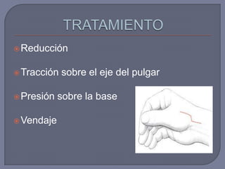  Reducción


 Tracción   sobre el eje del pulgar

 Presión   sobre la base

 Vendaje
 