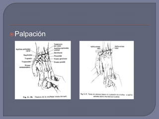  Palpación
 