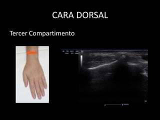 CARA DORSAL
Tercer Compartimento

 