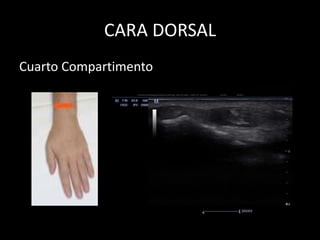 CARA DORSAL
Cuarto Compartimento

 