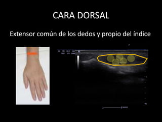 CARA DORSAL
Extensor común de los dedos y propio del índice

 