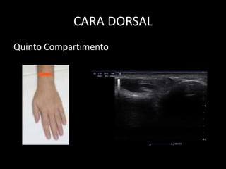 CARA DORSAL
Quinto Compartimento

 