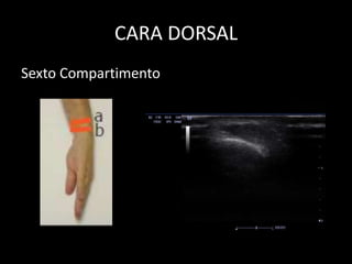 CARA DORSAL
Sexto Compartimento

 