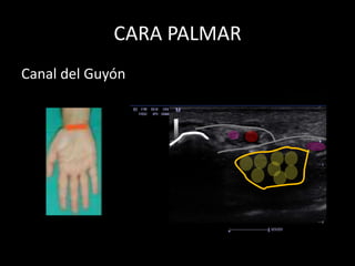 CARA PALMAR
Canal del Guyón

 