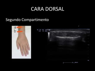 CARA DORSAL
Segundo Compartimento

 