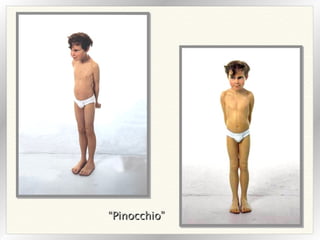 “ Pinocchio” 