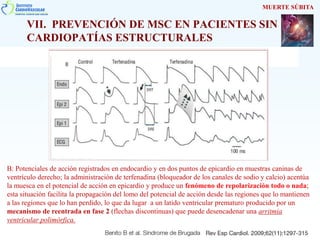 VII. PREVENCIÓN DE MSC EN PACIENTES SIN
CARDIOPATÍAS ESTRUCTURALES
MUERTE SÚBITA
B: Potenciales de acción registrados en endocardio y en dos puntos de epicardio en muestras caninas de
ventrículo derecho; la administración de terfenadina (bloqueador de los canales de sodio y calcio) acentúa
la muesca en el potencial de acción en epicardio y produce un fenómeno de repolarización todo o nada;
esta situación facilita la propagación del lomo del potencial de acción desde las regiones que lo mantienen
a las regiones que lo han perdido, lo que da lugar a un latido ventricular prematuro producido por un
mecanismo de reentrada en fase 2 (flechas discontinuas) que puede desencadenar una arritmia
ventricular polimórfica.
 