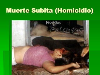 Muerte Subita (Homicidio)
 