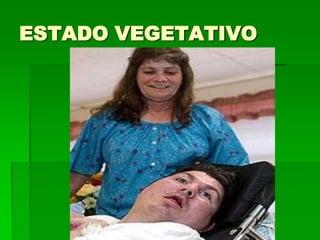 ESTADO VEGETATIVO
 