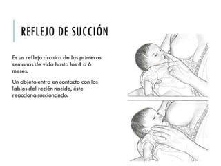 REFLEJO DE SUCCIÓN 
Es un reflejo arcaico de las 
primeras semanas de vida 
hasta los 4 o 6 meses. 
Un objeto entra en contacto 
con los labios del recién 
nacido, éste reacciona 
succionando. 
 