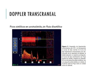 DOPPLER 
TRANSCRANEAL 
Picos sistólicos en protosístole, sin flujo diastólico 
 
