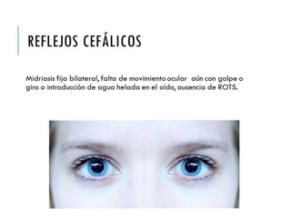 REFLEJOS CEFÁLICOS 
Midriasis fija bilateral, falta de movimiento ocular aún 
con golpe o giro o introducción de agua helada en el 
oído, ausencia de ROTS. 
 