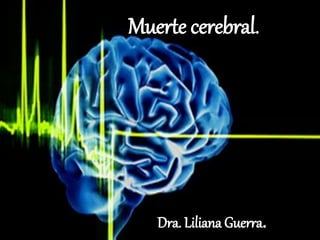 Muerte cerebral.
Dra. Liliana Guerra.
 