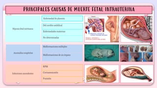 MUERTE INTRAUTERINA-SG3 (1) (2).pptx