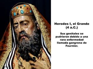 Herodes I, el Grande
      (4 a.C.)
    Sus genitales se
pudrieron debido a una
    rara enfermedad
 llamada gangrena de
        Fournier.
 