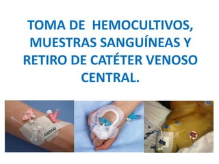 TOMA DE HEMOCULTIVOS,
MUESTRAS SANGUÍNEAS Y
RETIRO DE CATÉTER VENOSO
CENTRAL.
 