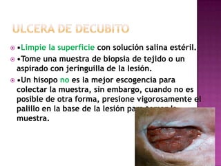  •Limpie la superficie con solución salina estéril.
 •Tome una muestra de biopsia de tejido o un
aspirado con jeringuilla de la lesión.
 •Un hisopo no es la mejor escogencia para
colectar la muestra, sin embargo, cuando no es
posible de otra forma, presione vigorosamente el
palillo en la base de la lesión para tomar la
muestra.
 