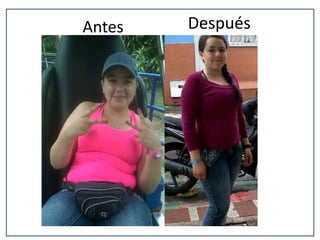 Antes

Después

 