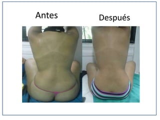 Antes

Después

 