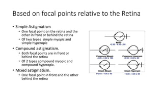 Based on focal points relative to the Retina
• Simple Astigmatism
• One focal point on the retina and the
other in front or behind the retina
• Of two types simple myopic and
simple hyperopic
• Compound astigmatism.
• Both focal points are in front or
behind the retina
• Of 2 types compound myopic and
compound hyperopic.
• Mixed astigmatism.
• One focal point in front and the other
behind the retina
 
