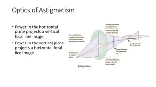 Optics of Astigmatism
• Power in the horizontal
plane projects a vertical
focal line image
• Power in the vertical plane
projects a horizontal focal
line image
 