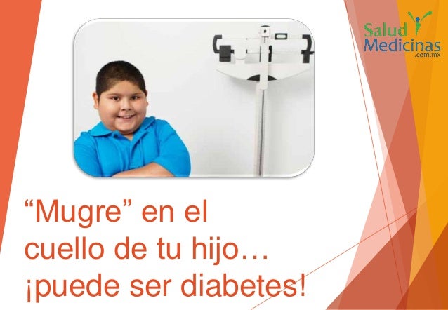 Mugre en el cuello de niños, signo de diabetes Mugre en el cuello de niños, signo de diabetes