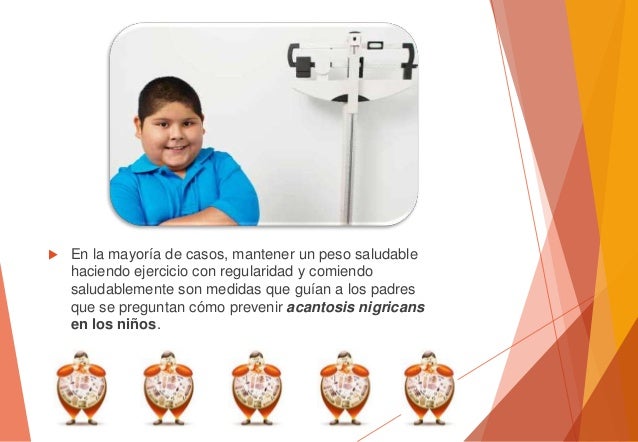 Mugre en el cuello de niños, signo de diabetes Mugre en el cuello de niños, signo de diabetes