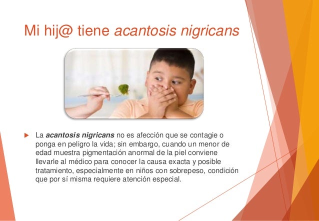 Mugre en el cuello de niños, signo de diabetes Mugre en el cuello de niños, signo de diabetes