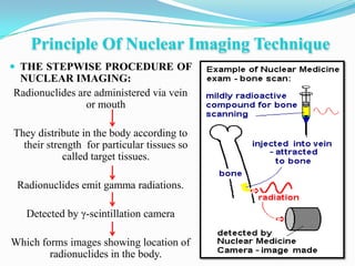 Principle Of Nuclear Imaging Technique
 THE STEPWISE PROCEDURE OF
 NUCLEAR IMAGING:
Radionuclides are administered via vein
                or mouth

They distribute in the body according to
  their strength for particular tissues so
            called target tissues.

 Radionuclides emit gamma radiations.

   Detected by γ-scintillation camera

Which forms images showing location of
        radionuclides in the body.
 
