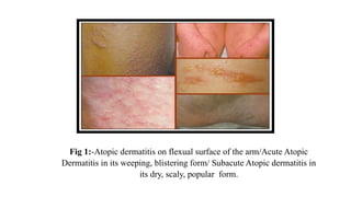 Presentation on Problems Associated With Skin | PPTX