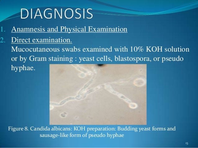 candida albicans koh