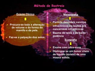 Mulher e Cancro da Mama