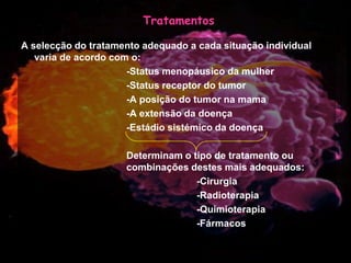 Mulher e Cancro da Mama