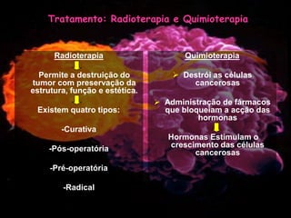 Mulher e Cancro da Mama