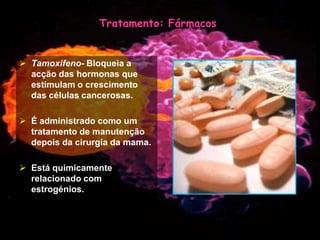 Mulher e Cancro da Mama