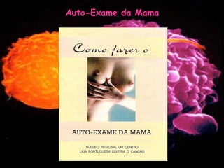 Mulher e Cancro da Mama