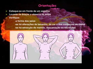 Mulher e Cancro da Mama