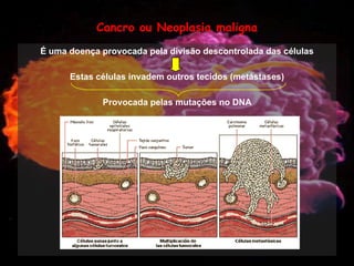 Mulher e Cancro da Mama