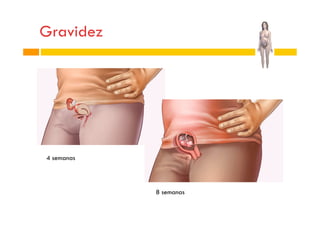 Gravidez

4 semanas

8 semanas

 