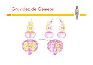 Gravidez de Gémeos

 