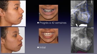 ©sylvainchamberland.com
•Progrès à 42 semaines  
 
 
 
 
 
•Initial
 