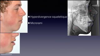 ©sylvainchamberland.com
•Hyperdivergence squelettique
•Microrami
 