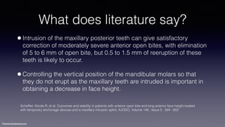 ©sylvainchamberland.com
What does literature say?
•Intrusion of the maxillary posterior teeth can give satisfactory
correction of moderately severe anterior open bites, with elimination
of 5 to 6 mm of open bite, but 0.5 to 1.5 mm of reeruption of these
teeth is likely to occur.
•Controlling the vertical position of the mandibular molars so that
they do not erupt as the maxillary teeth are intruded is important in
obtaining a decrease in face height.
Schefﬂer, Nicole R. et al. Outcomes and stability in patients with anterior open bite and long anterior face height treated
with temporary anchorage devices and a maxillary intrusion splint, AJODO, Volume 146 , Issue 5 , 594 - 602
 