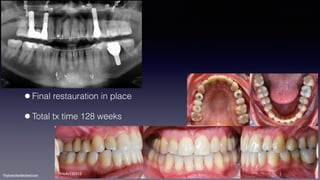©sylvainchamberland.com
•Final restauration in place
•Total tx time 128 weeks
HeAr120312
 