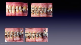 ©sylvainchamberland.com
 