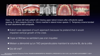 ©sylvainchamberland.com
•Kokich was opposed of such approach because he pretend that it would
impaired vertical growth of the crest.
•Cope et Wilmes ne semblent pas s’en inquiéter.
•Melsen a démontré qu’un TAD perpendiculaire maintient le volume BL de la crête
•Qui dit vrai?
Case 1. A. 14-year-old male patient with missing upper lateral incisors after orthodontic space
opening. B. Mini-implants (2mm Å~ 13mm) inserted in lateral incisor spaces. C. Temporary crowns bonded
to resin abutments with composite.
Mini-Implant-Supported Temporary Pontics, WILMES B,NIENKEMPER M, RENGER S, DRESCHER D,© 2014 JCO, July VOLUME XLVIII NUMBER 7; 422-9
 