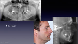 ©sylvainchamberland.com
•Tx Plan?
 