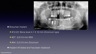 ©sylvainchamberland.com
•Strauman implant
✦ #12-22: Bone level 4,1 X 10 mm Zirconium type
✦ #37: 4,8 X 6 mm WNI
✦ #44: 3,3 X 6 mm Zirconium
•Implant 44 failed and has been replaced
SeCa220513
 