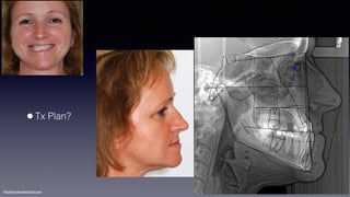 ©sylvainchamberland.com
•Tx Plan?
 